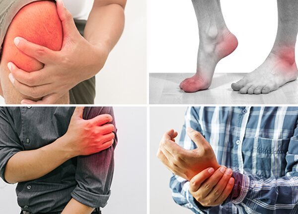 Cảnh báo những dấu hiệu của bệnh viêm khớp dạng thấp