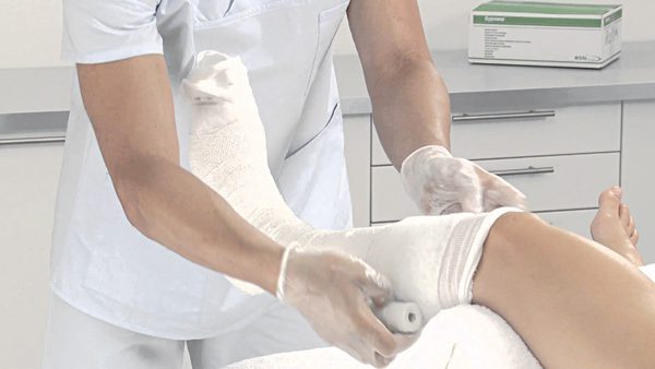 Chăm sóc bệnh nhân bó bột gãy xương