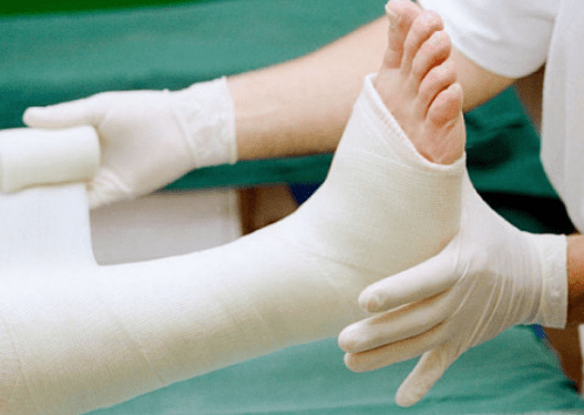 Chăm sóc bệnh nhân bó bột gãy xương