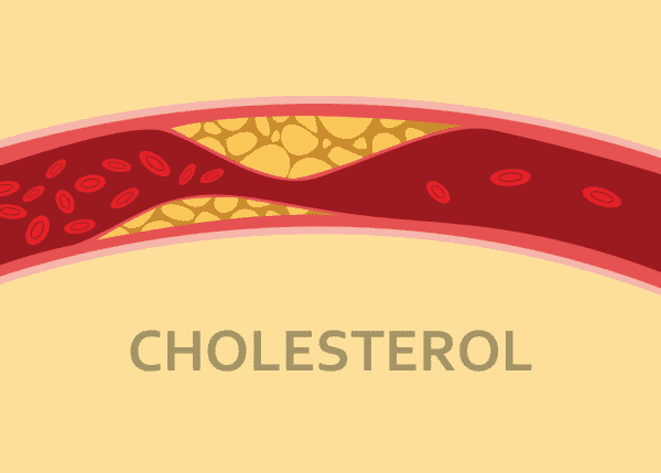 Cholesterol