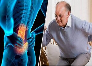 Phương pháp điều trị thoái hóa cột sống ở người cao tuổi
