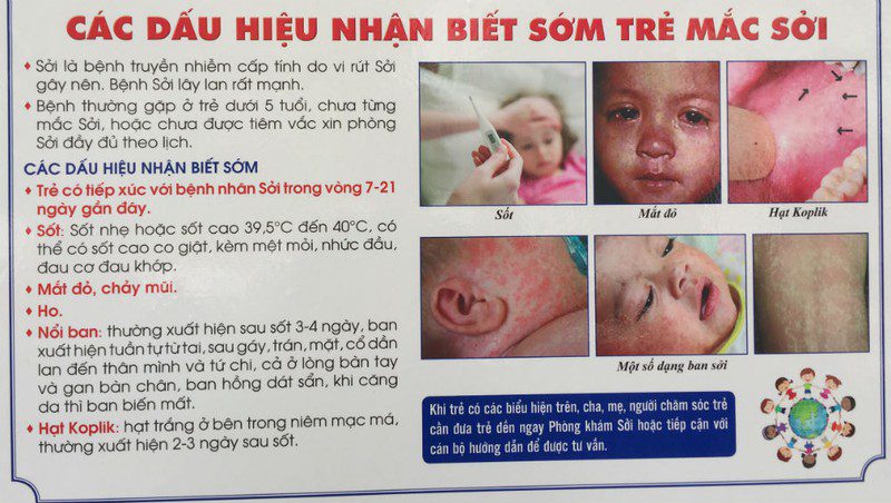 Dấu hiệu nhận biết bệnh sởi