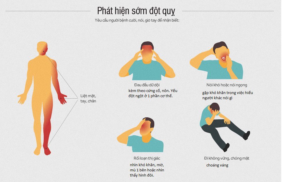 duoc si ha noi canh bao su nguy hiem cua benh dot quy