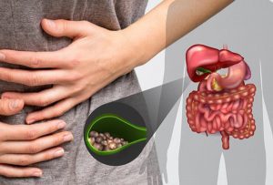 ha noi khuyen ban thay doi thoi quen cua minh de day lui soi mat