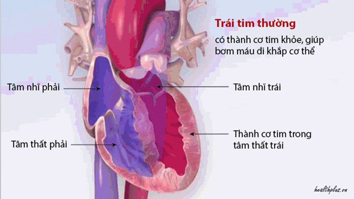 nhung dieu ban chua biet ve benh rung nhi – roi loan nhip tim