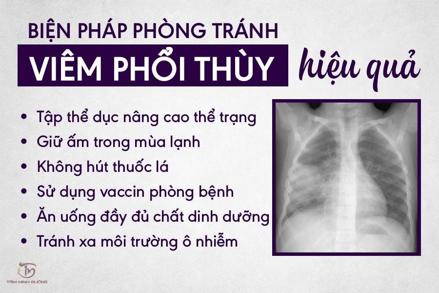 Biện pháp phòng chống viêm phổi thùy