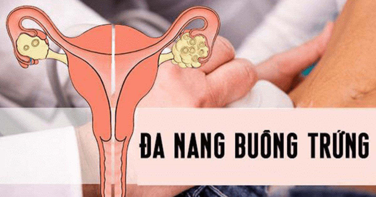 roi loan phong noan anh huong toi suc khoe sinh san nhu the nao 2