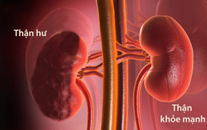 than cua ban dang chet dan chet mon chi vi 10 ly do sau day