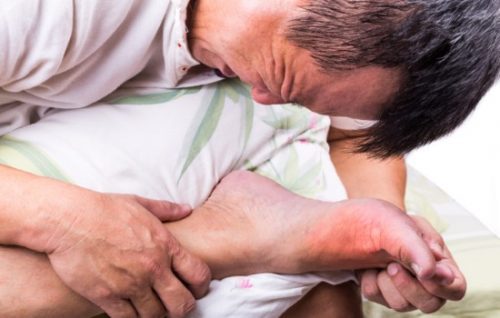 Tìm hiểu về bệnh lý sốt thấp khớp