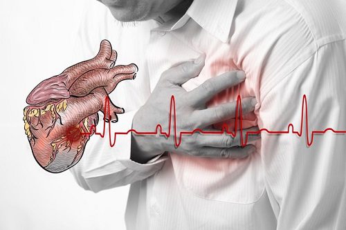 Tuân thủ theo chỉ định của bác sĩ trong điều trị thiếu máu cơ tim