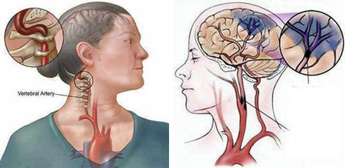 Đột ngụy là một căn bệnh nguy hiểm