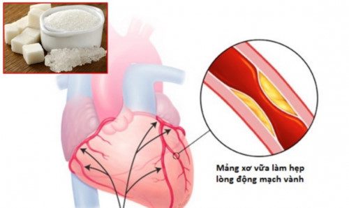 Đông mạch vành thường mắc ở những người lớn tuổi