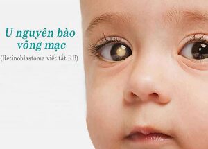 20200823 155707 117163 1080 crop u nguyen max 1800x1800 1 1