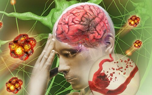Hà Nội cách phòng thiếu máu não bảo vệ sức khỏe của bạn