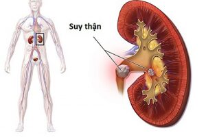 CC3B9ng tC3ACm hiE1BB83u bE1BB87nh suy thE1BAADn mE1BAA1n qua 4 giai C491oE1BAA1n cE1BBA7a bE1BB87nh