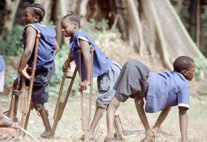 Cha mẹ đừng chủ quan với bệnh bại liệt ở trẻ