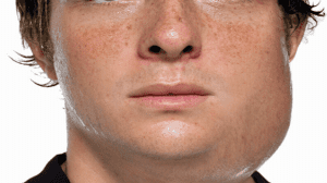 Quai bị một căn bệnh nguy hiểm