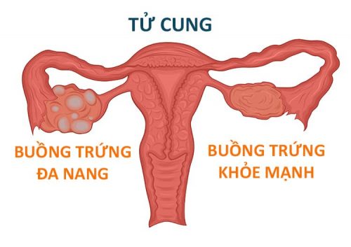 buong trung da nang 1 e1555379747713