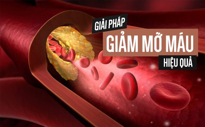 cach giam mo mau 1