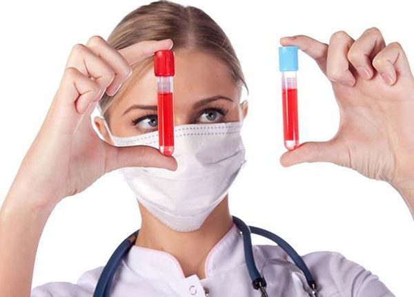 Chỉ số bilirubin là gì và nguyên nhân nào gây nên tăng bilirubin máu?