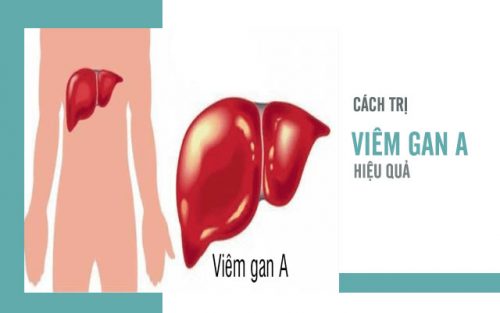 chua viem gan a e1547352965154 1