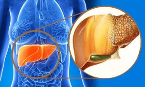 Chuyên gia Điều dưỡng Hà Nội khuyên bạn những thực phẩm cần tránh vì hại gan