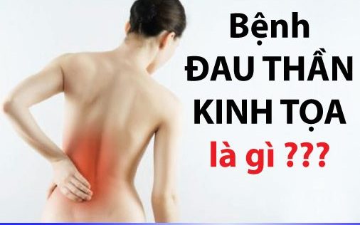 dau than kinh toa la gi