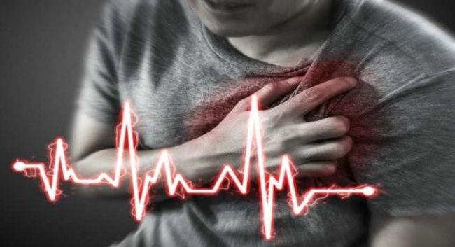 Biểu hiện của cơn đau thắt ngực điển hình