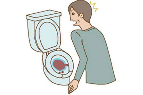 Đi tiểu ra máu là một triệu chứng trực tiếp của bệnh thận