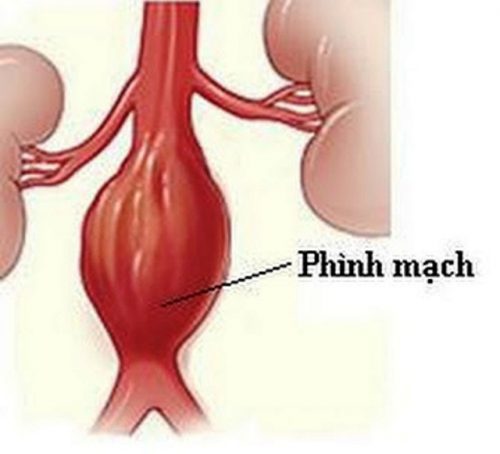 Điều trị các vấn đề tim mạch