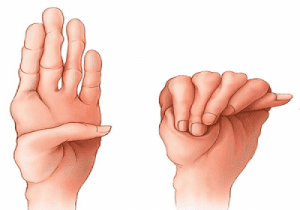 Phương pháp điều trị và thuốc sử dụng