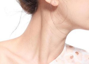 Khi một người bị nổi hạch ở cổ báo hiệu bệnh gì ?