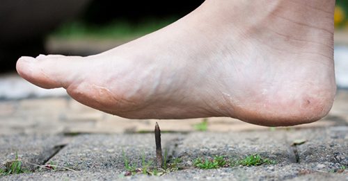 Vi khuẩn uốn ván xâm nhập vào cơ thể thông qua vết thương hở