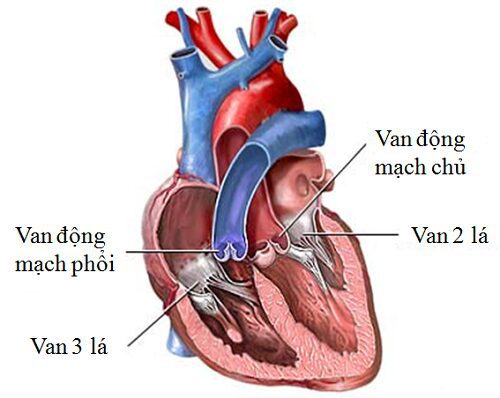 Bệnh hở van tim là căn bệnh như thế nào?
