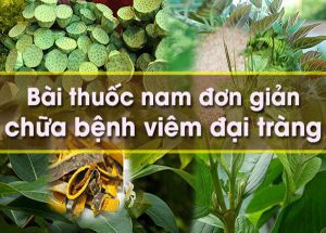 nhe1bbafng bc3a0i thue1bb91c nam tre1bb8b vic3aam c491e1baa1i trc3a0ng 1