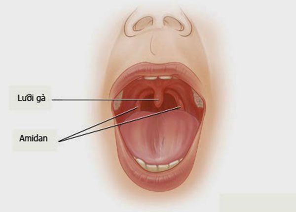 Những thực phẩm nào bệnh nhân ung thư amidan nên bổ sung?