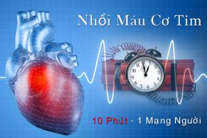 Phát Hiện Sớm Nguy Cơ Nhồi Máu Cơ Tim