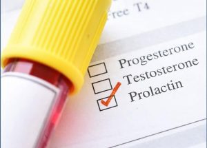 prolactin tang cao 1