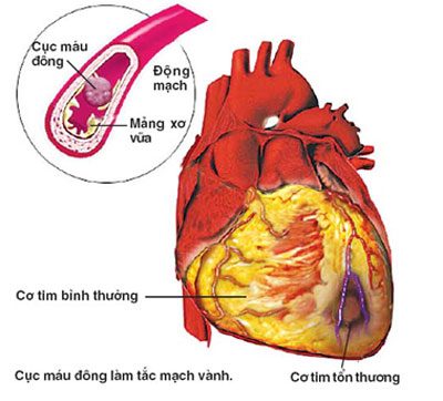 tim 25413 7434c