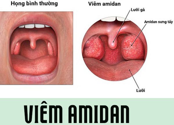 vic3aam amidan 2