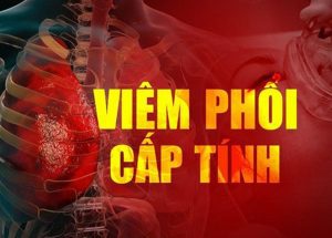 vic3aam phe1bb95i ce1baa5p tc3adnh cc3b3 the1bb83 gc3a2y ra nhie1bb81u bie1babfn che1bba9ng nguy hie1bb83m 2