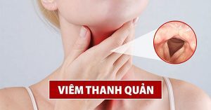 Bài thuốc dưỡng phế trong YHCT trị viêm thanh quản