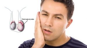 viem tinh hoan sau quai bi 1