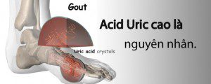 Điều trị bệnh gout bằng phương pháp xoa bóp và bài thuốc