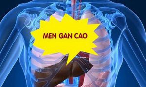 Bệnh men gan cao là gì? Vậy cần làm gì khi bị men gan cao?