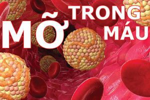 benh-mo-mau