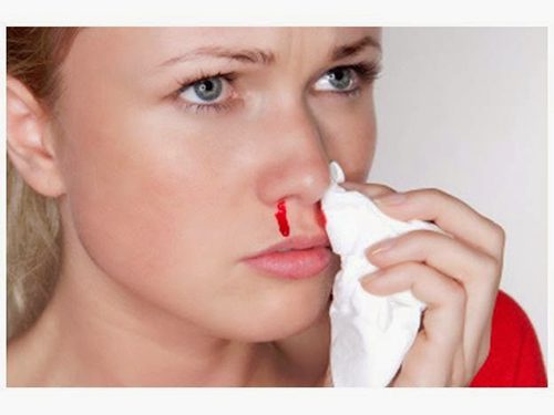 Chảy máu cam: Nguyên nhân, điều trị và phòng ngừa