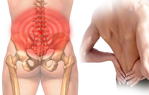 Áp dụng bài thuốc đau thắt lưng từ lá lốt