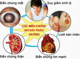 Kiểm soát bệnh tiểu đường bằng thực phẩm thường ngày