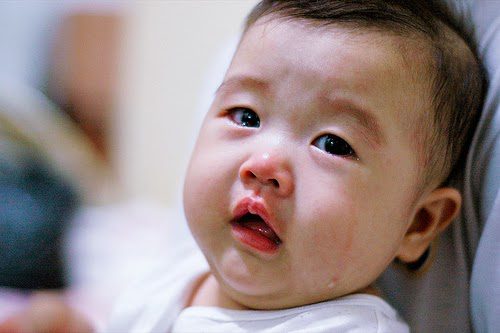 Những mẹo vặt giúp bé giảm đau do mọc răng hiệu quả
